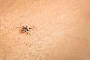 Tick Treatment & Removal in Needham MA